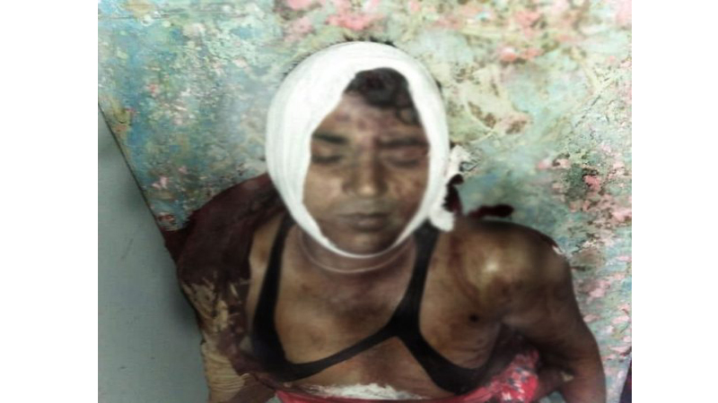 কোম্পানীগঞ্জে ডাকাত দলের ছুরিকাঘাতে পাথর শ্রমিক খুন