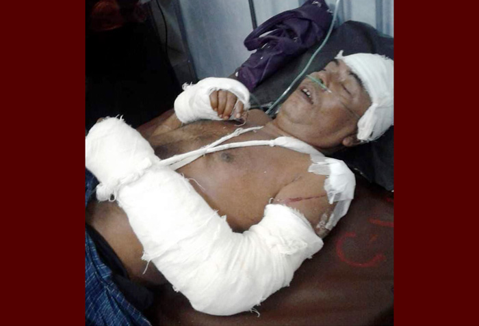 কানাইঘাটে কারিতাসের টিউবওয়েল বসানোর জেরে হামলার ঘটনায় মামলা