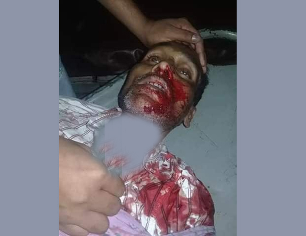 সিলেট নগরীতে এক চাকুরীজীবী খুন