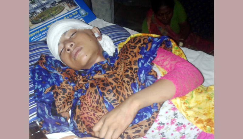 ওসমানী হাসপাতালে কুলাউড়ার সামিরার অবস্থা সঙ্কটাপন্ন