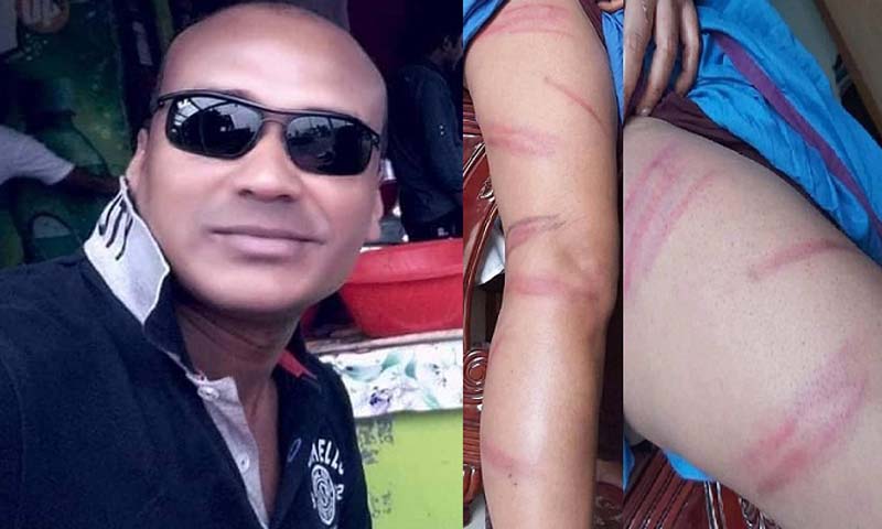 চাঁদা না দেওয়ায় নারী কর্মকর্তাকে মারধর করলো সাবেক ছাত্র নেতা