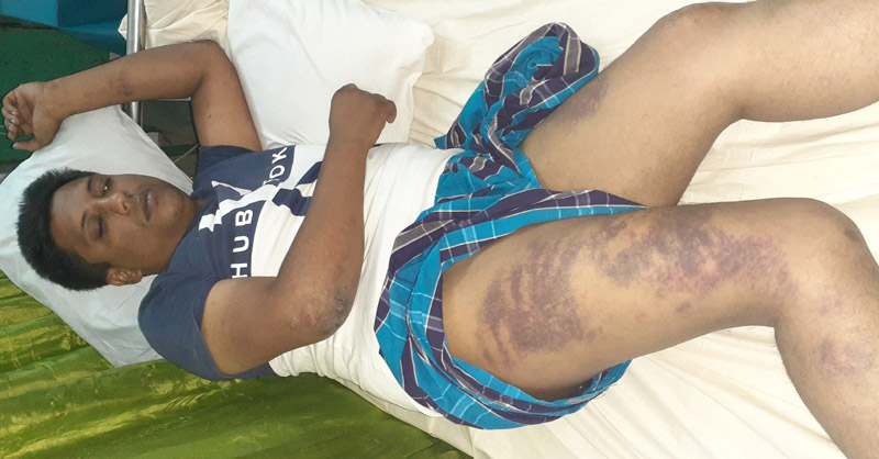 পুলিশ হেফাজতে পিছন হাতকড়া পরিয়ে ও চোখ বেঁধে যুবককে অমানুষিক নির্যাতন