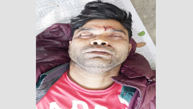 সিলেটের শাহজালাল মাজারে অজ্ঞাত যুবকের লাশ উদ্ধার