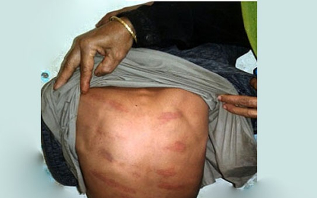 হবিগঞ্জে মাদ্রাসা শিক্ষার্থীকে পিটিয়ে জখম, দুই শিক্ষক আটক