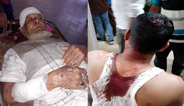 দক্ষিণ সুরমায় ড্রেইনের পাইপ বসানোকে কেন্দ্র করে হামলা, আহত ৩