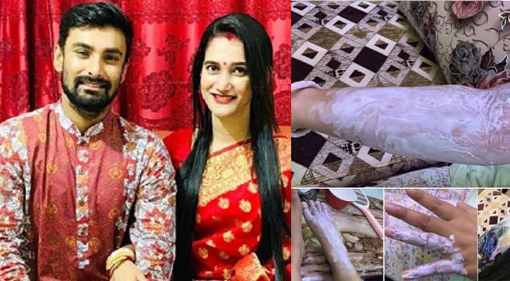 অল্পের জন্য প্রাণে বাঁচলেন লিটনের স্ত্রী