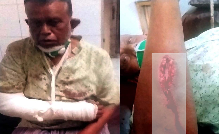 গোলাপগঞ্জে বিদ্যুৎ সংযোগ নিয়ে বিরোধ: বৃদ্ধকে নির্যাতন