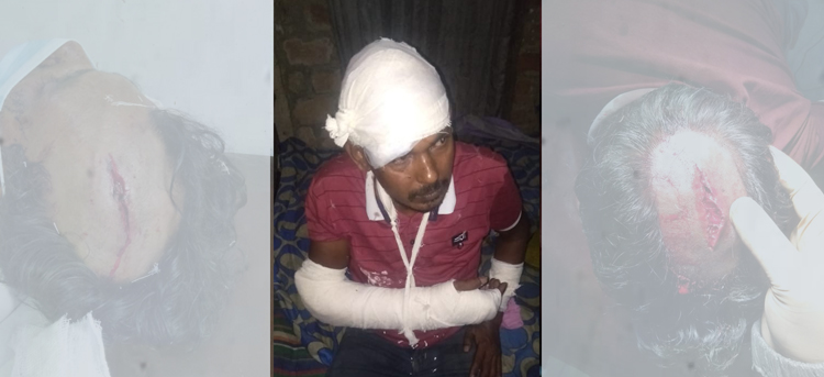 দক্ষিণ সুরমায় প্রতিপক্ষের হামলায় নারীসহ আহত ৩, মামলা দায়ের