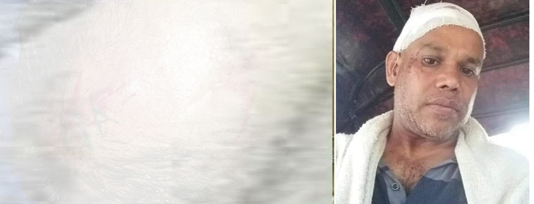 বিশ্বনাথে প্রতিপক্ষের হামলায় আহত ২, থানায় অভিযোগ দায়ের