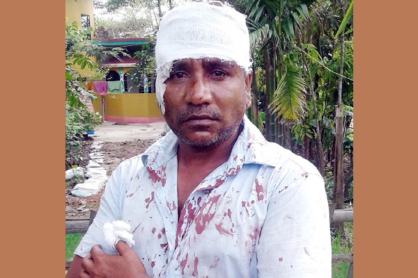 বিশ্বনাথে সন্ত্রাসী হামলায় আহত সাংবাদিক শিপন: প্রেসক্লাবের নিন্দা