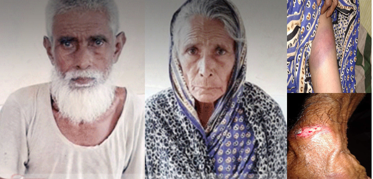 তাহিরপুরে বাবা ও মাকে পিটিয়ে হাসপাতালে পাঠিয়েছে মেয়ে ও নাতিরা