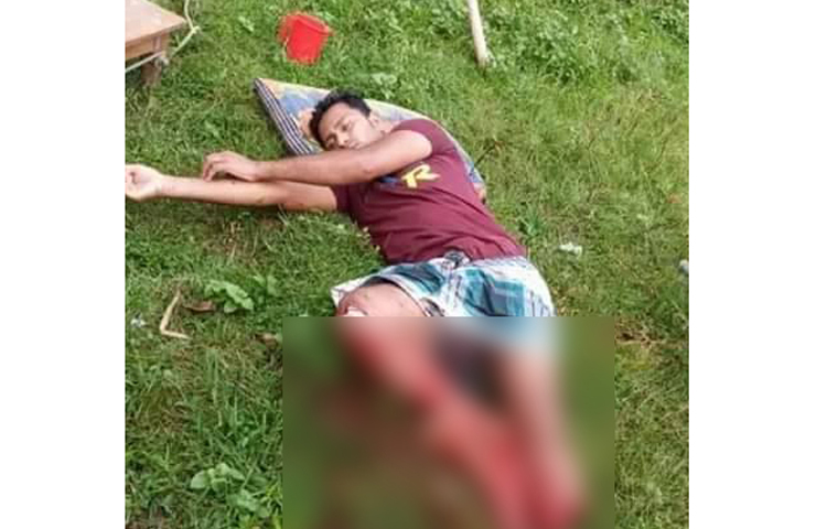 কানাইঘাটে এক যুবককে উপর্যুপরি কোপি পা কেটে ফেলেছে দুর্বৃত্তরা