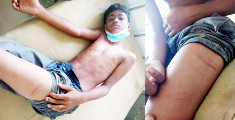 শিক্ষার্থীকে রড দিয়ে পেটালেন শিক্ষক