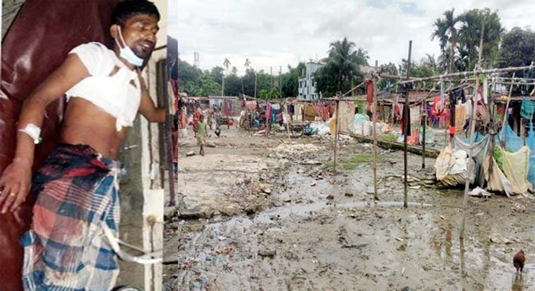 নগরীর ঘাসিটুলায় মোবাইল ছিনতাইকে কেন্দ্র করে ভাতিজার ছুরিকাঘাতে চাচা গুরুতর