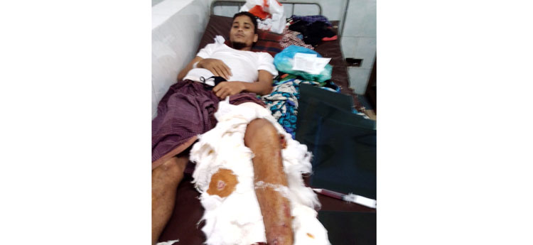 কানাইঘাটে সালিশ বিচারে ন্যায় সঙ্গত কথা বলায় আলেমকে কোপিয়ে গুরুতর জখম