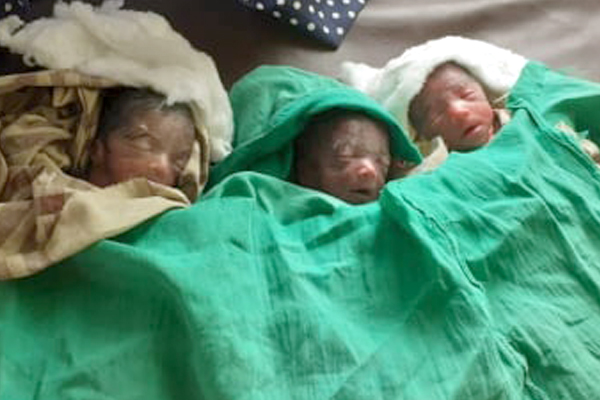 কানাইঘাটে একসাথে স্বাভাবিক জন্ম হলো তিন নবজাতকের