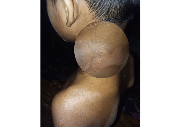 জৈন্তাপুরে শিক্ষকের বিরুদ্ধে শিশু ছাত্রকে নির্যাতনের অভিযোগ