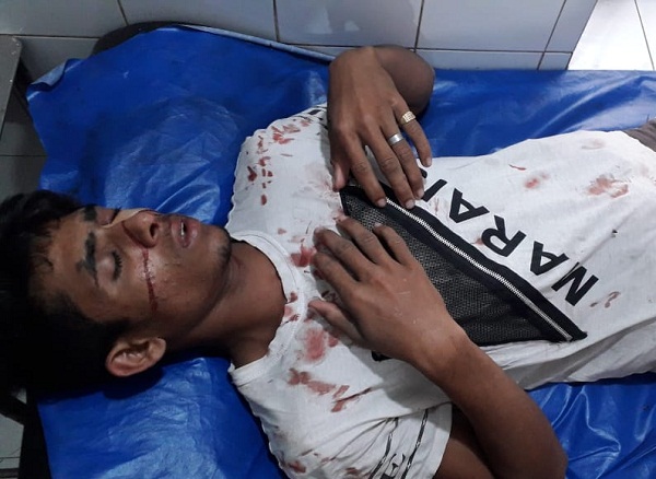 দিরাইয়ে সংঘর্ষে একজন গুলিবিদ্ধসহ আহত ১০