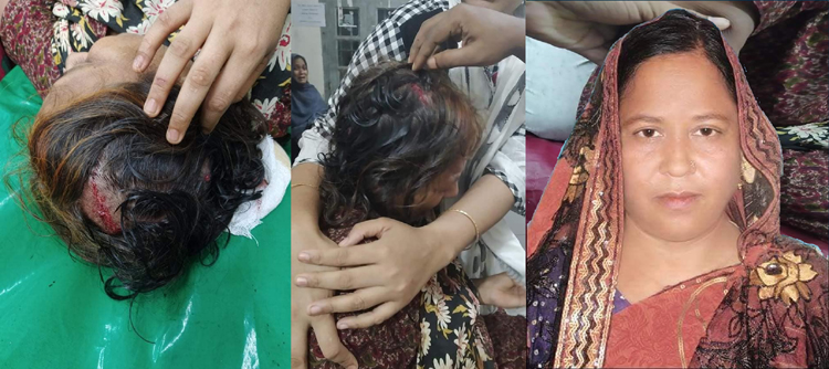 কমলগঞ্জে সাবেক নারী ইউপি সদস্যের উপর মধ্যযুগিয় কায়দায় হামলা