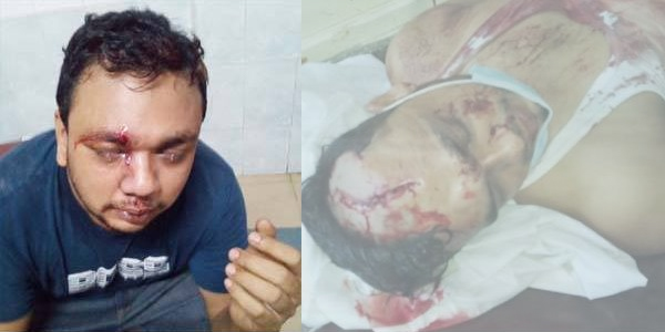 বিশ্বনাথে প্রতিপক্ষের হামলায় মহিলাসহ আহত ৬