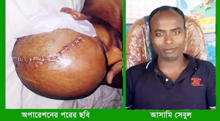 অবশেষে বিশ্বনাথের সেবুল গ্রেফতার