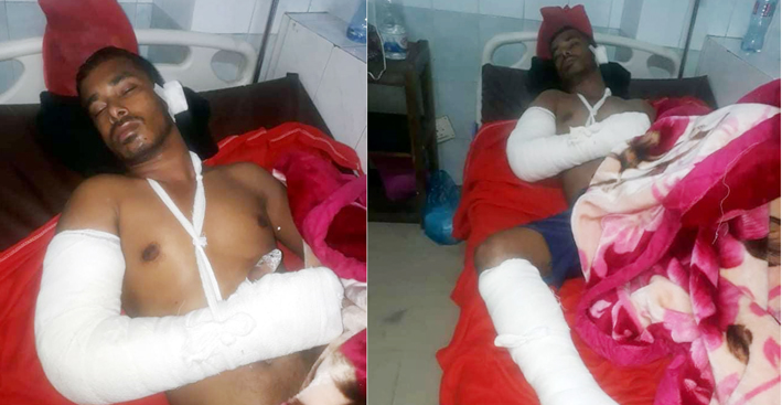 মোগলাবাজারে সন্ত্রাসী হামলায় যুবক গুরুতর : মামলা দায়ের