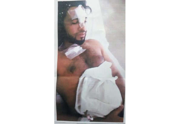 বিশ্বনাথে সড়ক থেকে যুবককে কুপানোর ঘটনায় মামলা