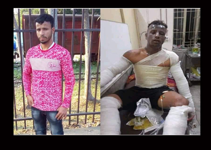 বিশ্বনাথে গ্যাস সিলিন্ডার বিষ্ফোরণে মায়ের পর ছেলের মৃত্যু