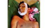 কানাইঘাটে গাছ থেকে পড়ে তরুণের মর্মান্তিক মৃত্যু
