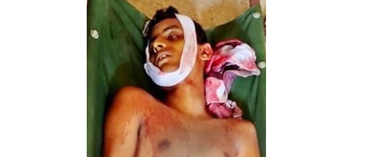 কানাইঘাটে গাছ থেকে পড়ে তরুণের মর্মান্তিক মৃত্যু