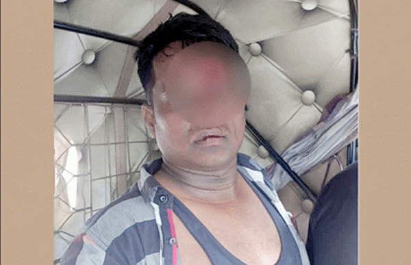 বিশ্বনাথে অতর্কিত হামলায় ফল ব্যবসায়ী আহত