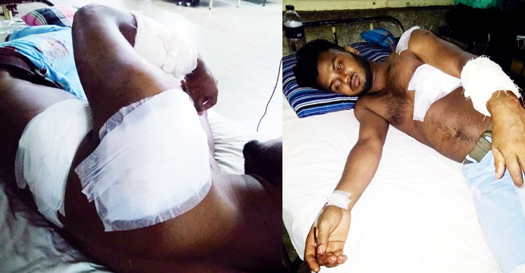 কোম্পানীগঞ্জে চাঁদা না দেওয়ায় যুবকের হাতের কেটে দিলেন সন্ত্রাসীরা!