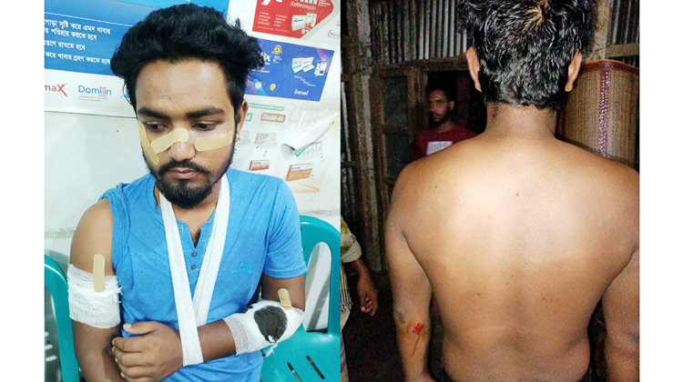 গোয়াইনঘাটে দুর্বৃত্তদের হামলায় যুবক গুরুত্বর আহত, থানায় অভিযোগ