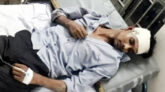 বিশ্বনাথে প্রতিপক্ষের হামলায় সাবেক ইউপি সদস্য আহত