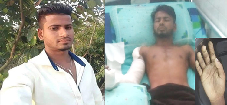গোয়াইনঘাটে প্রতিপক্ষের দায়ের কোপে বিচ্ছিন্ন কলেজ ছাত্রের হাত, অস্ত্রোপচার সম্পন্ন