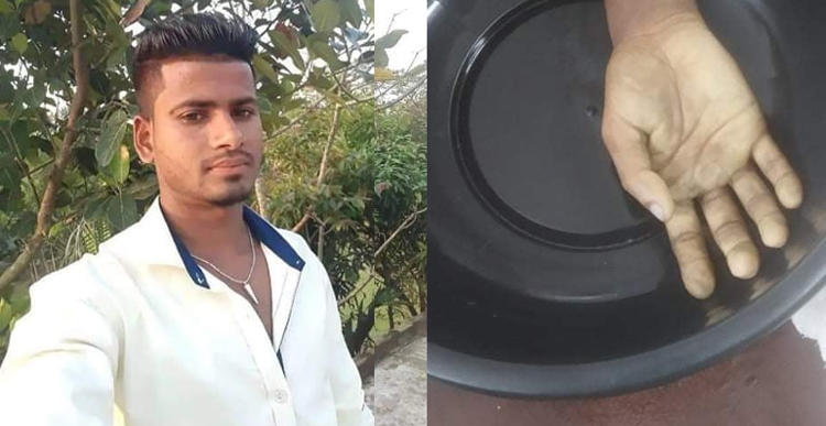 গোয়াইনঘাটে তালতো ভাইয়ের বটির কোপে যুবকের হাতের কবজি দুইভাগ