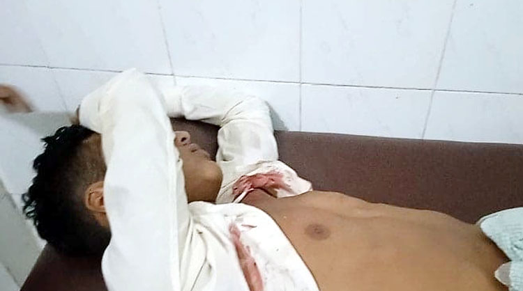 কানাইঘাটে যুবকে কুপিয়ে আহত থানায় অভিযোগ দায়ের