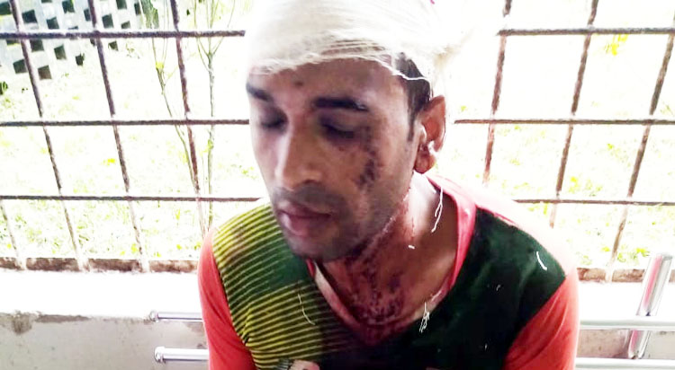 কানাইঘাটে স্ত্রীকে উত্যক্তের প্রতিবাদ করার হামলা, স্বামী গুরুতর আহত