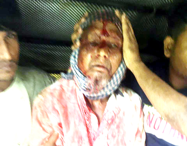 জকিগঞ্জে ভাতিজাদের মারপিটে চাচা গুরুতর আহত : আটক ২