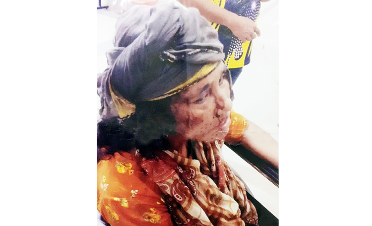 গোয়াইনঘাটে সন্ত্রাসী হামলায় এক পরিবারের ৩ নারী আহত
