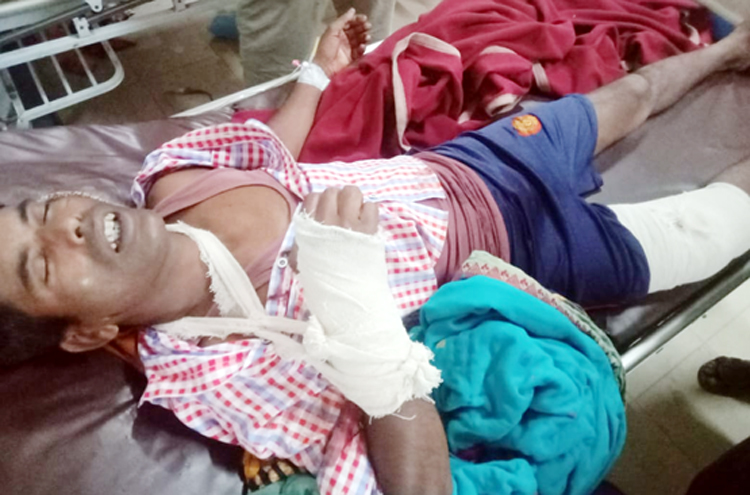 মৌলভীবাজারে ইটভাটা শ্রমিককে কুপিয়েছে দুর্বৃত্তরা : থানায় অভিযোগ