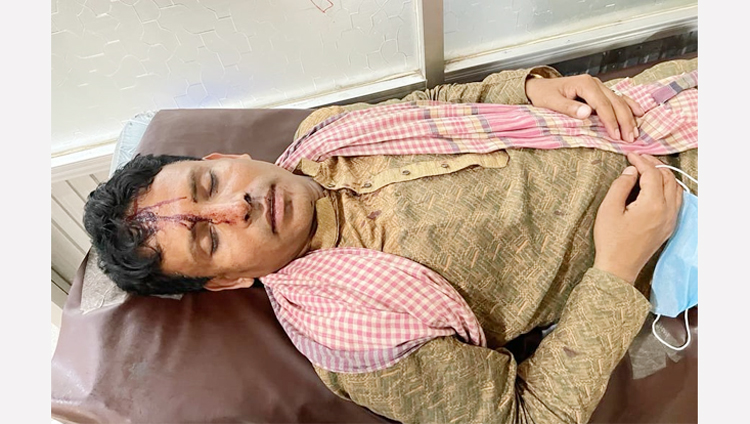 কোম্পানীগঞ্জে সালিশ বিচারে ইউপি সদস্যের হামলায় চেয়ারম্যান আহত