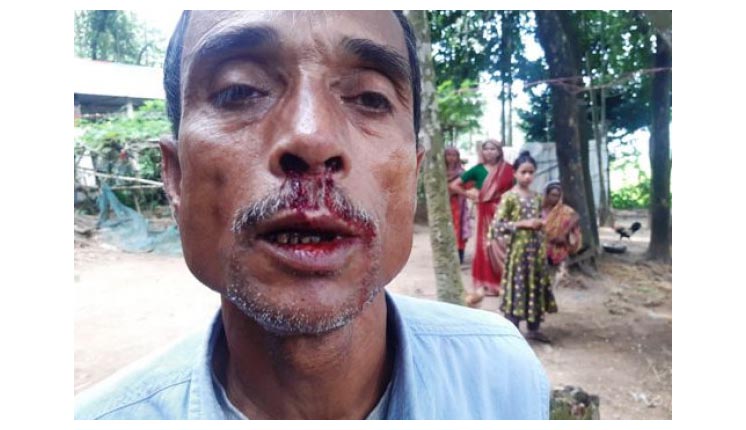 তাহিরপুরে আবারো সাংবাদিকের উপর হামলা