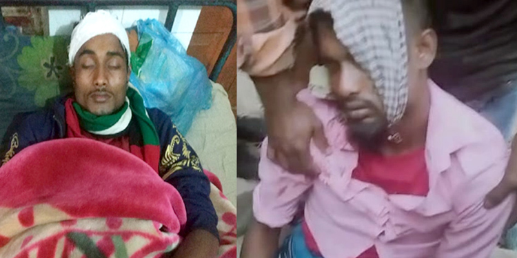 টাকা ধার না দেয়ায় হামলা : কানাইঘাটে দুই ভাই আহত