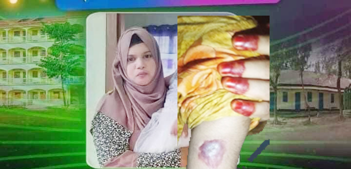 সিলেটে গৃহকর্মী জান্নাত নির্যাতন : পলাতক নার্স শাহনাজকে খুঁজছে পুলিশ