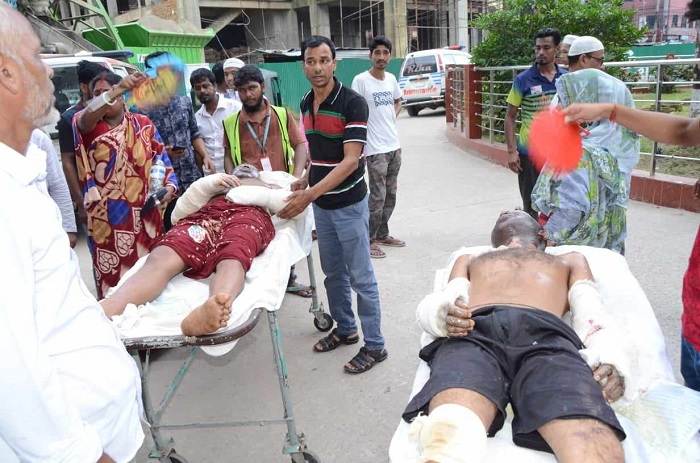 দগ্ধদের শরীরের প্রায় ৪০ শতাংশ পুড়ে গেছে : অবস্থা আশঙ্কাজনক