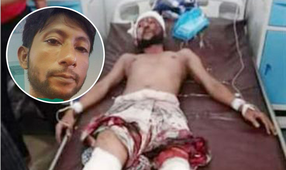 দক্ষিণ সুরমায় দুর্বৃত্তদের হামলায় যুবলীগ নেতা গুরুতর আহত