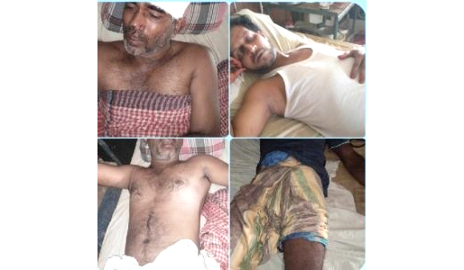 নবীগঞ্জে সন্ত্রাসী হামলায় সাংবাদিক মুজিবুরসহ আহত ৭